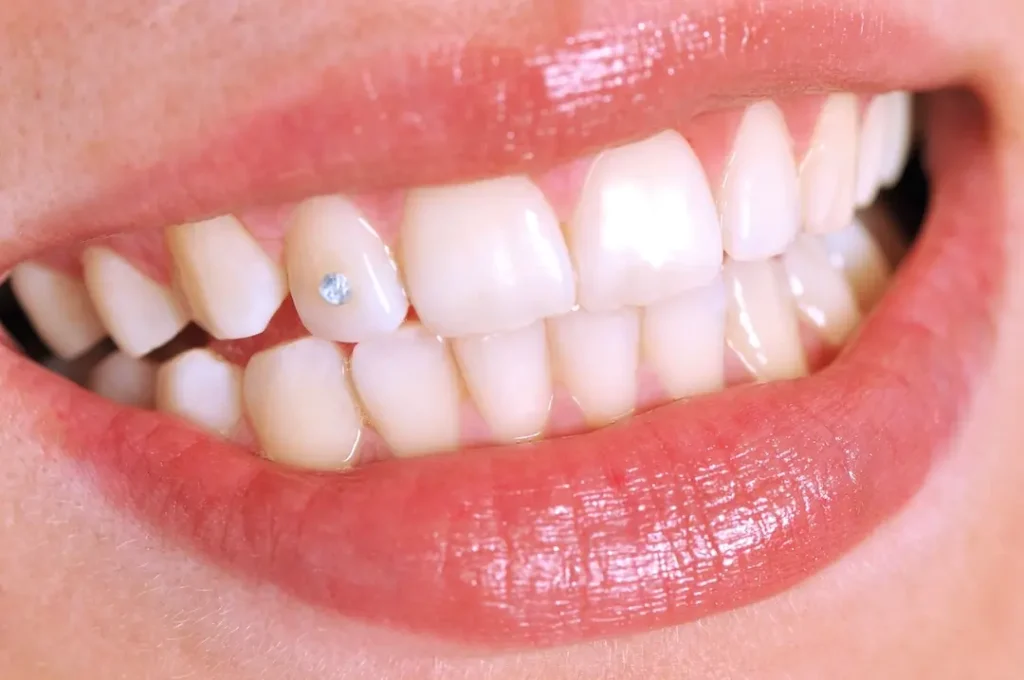 Manteniment Joies Dentals