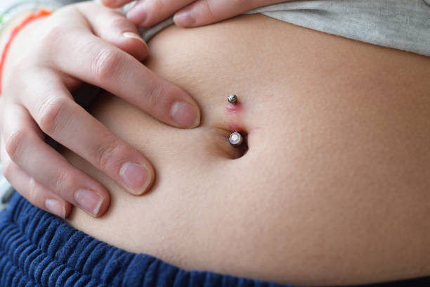 Piercing Infectat o irritat