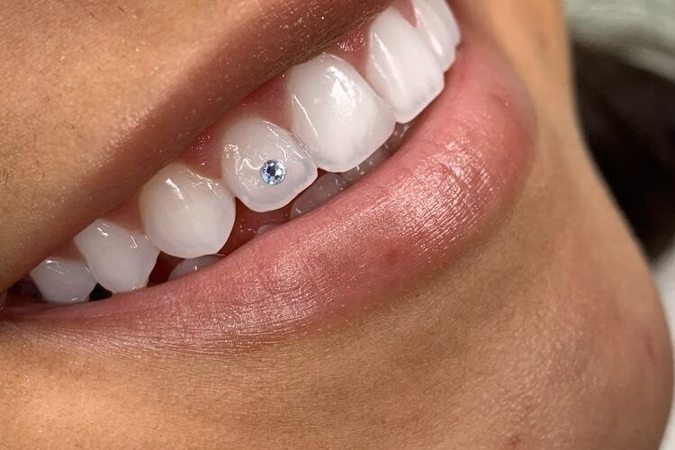Joia Dental Manresa